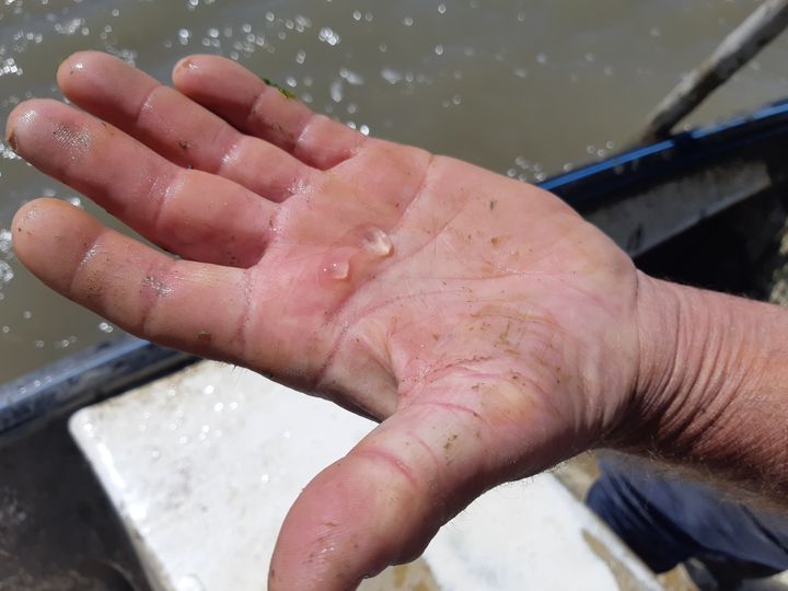 Petites méduses translucides nommée groseilles des mers à l'étang de l'Or près de Montpellier. (Radio France - Solenn Le Hen)