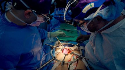 Cette image du 14 juillet 2023, diffusée par NYU Langone Health, à New York, montre une équipe de chirurgiens transplantant un rein de porc. (JOE CARROTTA / NYU LANGONE HEALTH / AFP)