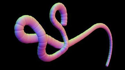 Le virus Ebola (APA / SCIENCE PHOTO LIBRARY)