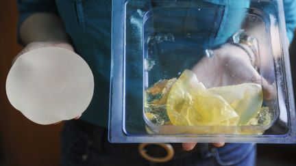 Une proth&egrave;ses mammaire PIP d&eacute;chir&eacute;e (D) &agrave; c&ocirc;t&eacute; d'une autre en bon &eacute;tat, photographi&eacute;es dans un h&ocirc;pital de Caracas (Venezuela), le 5 janvier 2012. (LEO RAMIREZ / AFP)