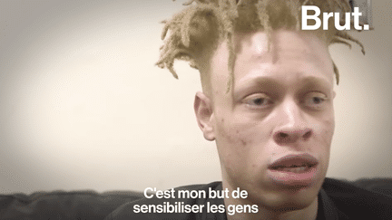 Leo Jonah est un mannequin albinos. Victime de harcèlement scolaire pendant son enfance, il a un message à faire passer.