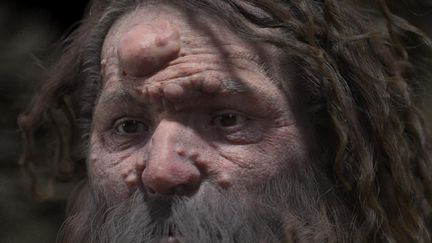 Les nodules sur le visage reconstitué de Cro-Magnon 1, à&nbsp;Montigny-le-Bretonneux (Val-d'Oise) le 19 mars 2018. (FROESCH/CHARLIER/VISUALFORENSIC)