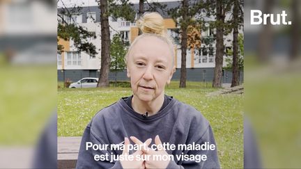 “Je suis belle, je ne suis pas là pour plaire à qui que ce soit.” Amélie a 17 ans et est atteinte d’une pathologie qui lui relâche la peau de son visage. Sur les réseaux-sociaux, elle tente d’informer ses abonnés sur la maladie.