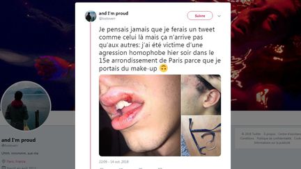 Capture d'écran du compte Twitter de Lostoverr où il raconte l'agression dont il a été la cible, le 14 octobre 2018. (LOSTOVERR / TWITTER)