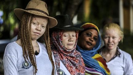 L’albinisme est caractérisée par un faible taux de mélanine dans le sang conduisant à une absence de pigmentation de la peau, des poils, des cheveux et des yeux. Les albinos sont souvent mal-voyants et sujets à des cancers de la peau. (BUNYAMIN AYGUN / MILLIYET DAILY / AFP)