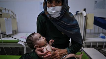 Un bébé traité pour malnutrition, le 22 novembre 2021 au centre MSF d'Herat (Afghanistan). (HECTOR RETAMAL / AFP)