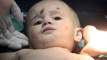 Cet enfant de deux ans a été enseveli par les débris de ces frappes russes. Il a été sauvé et pris en charge dans un hôpital. (IBRAHIM EBU LEYS / ANADOLU AGENCY / AFP)