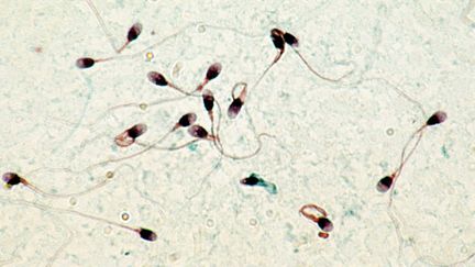 Des spermatozo&iuml;des humains vus au microscope. (DURAND FLORENCE/SIPA / SIPA)