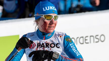 Anna Medvedeva finit le visage en sang l'épreuve de 15 km de ski de fond aux championnats du monde de Lathi (Finlande),&nbsp;le 25 février 2017. (ALEXEI DANICHEV / SPUTNIK / AFP)