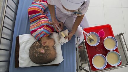 Le directeur explique que les problèmes de santé de plus des deux tiers de ses 60 enfants sont dus à l’agent orange.  (REUTERS/Damir Sagolj )