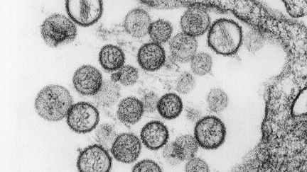 Image de l'hantavirus transmise par le Centre f&eacute;d&eacute;ral de contr&ocirc;le et de pr&eacute;vention des maladies am&eacute;ricain (CDC). (REUTERS)