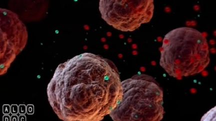 Une thérapie innovante pour un type de cancer du sein très agressif