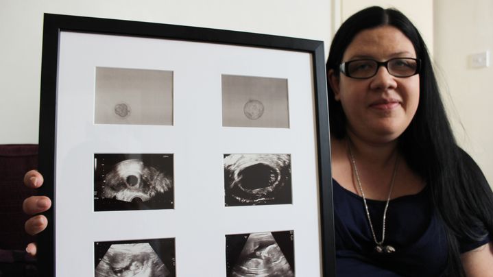 Annie Dunkley pose avec les &eacute;chographies du pr&eacute;c&eacute;dent b&eacute;b&eacute; qu'elle a port&eacute; pour une famille britannique, &agrave; son domicile de Rugby (Royaume-Uni), le 29 septembre 2014. (MATHIEU DEHLINGER / FRANCETV INFO)