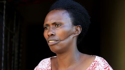 Alphonsine Mukamfizi, 42 ans, a surv&eacute;cu &agrave; trois tentatives d'assassinat. Elle a fait la morte pour &eacute;chapper &agrave; l'une d'elles. Elle garde une&nbsp;profonde entaille sur le visage. Les onze membres de sa famille ont &eacute;t&eacute; tu&eacute;s pendant le g&eacute;nocide. (NOOR KHAMIS / REUTERS)