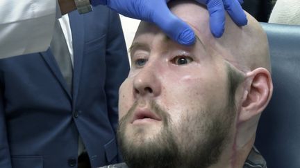 Le patient receveur de la première greffe d'un œil complet, Aaron James, examiné par un chirurgien, le 23 octobre 2023, à New York (Etats-Unis). (JOSEPH. B. FREDERICK / AP / SIPA)