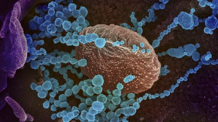 Le coronavirus SARS-CoV-2 vu au microscope électronique, le 27 février 2020. (AFP / NATIONAL INSTITUTES OF HEALTH)