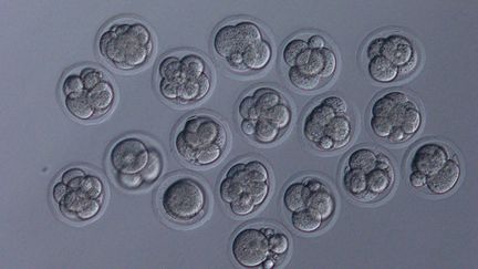 Mouse embryos conceived from sperm stored on the International Space Station, photographed at Yamanashi University (Japan), June 18, 2020. (TERUHIKO WAKAYAMA / UNIVERSITY OF YAMANASHI / AFP)