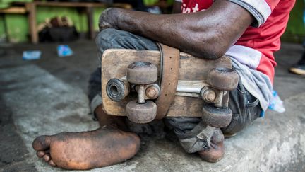 Atteint enfant&nbsp;par la poliomyélite, cet&nbsp;adolescent ghanéen a perdu l'usage d'une jambe. Avec d'autres jeunes, il joue de temps en temps au football en fixant une planche à roulettes du côté invalide&nbsp;de son corps (photo du 15 mai 2017). (JORDI PERDIGO / ANADOLU AGENCY)