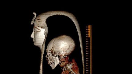 Image de la tête d'Amenhotep 1er par&nbsp;tomographie. (EGYPTIAN MINISTRY OF ANTIQUITIES HANDOUT / MAXPPP)