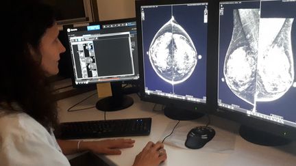 Une radiologue de l'hôpital Tenon à Paris étudie sur des écrans des images de sein. (SOLENNE LE HEN / FRANCE-INFO / RADIO FRANCE)