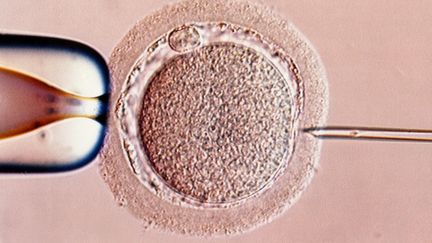 Injection&nbsp;de spermatozoïde dans un ovocyte à l'aide d'une micro-pipette en vue d'une fécondation in vitro, au CHU de Bordeaux,en 2003.&nbsp; (PHANIE / AFP)