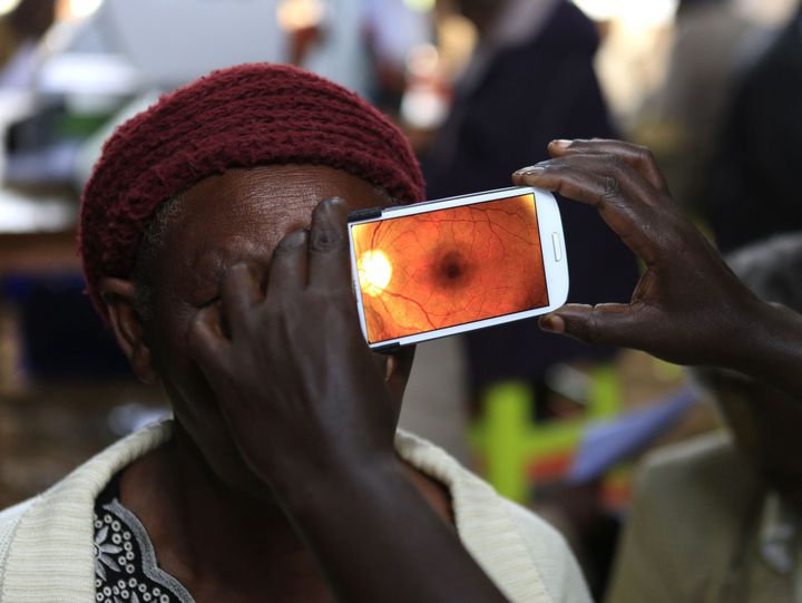 Un médecin examine le fond de l'oeil d'une patiente qui souffre de la cataracte à l'aide de l'application «Peek Vision» installée sur un smartphone le 29 octobre 2013 dans une clinique du Kenya. (Photo Reuters/Noor Khamis)