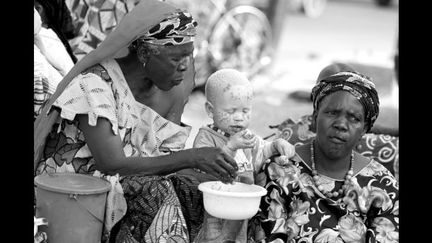 En Afrique les Albinos sont menacés de crime en raison de croyances ancestrales, ils sont perçus comme des génies ou des descendants de génies, aux pouvoirs maléfiques ou bénéfiques. Les ONG présentes sur place protègent les enfants porteurs d&#039;albinisme et les mères souvent considérées comme génitrices d&#039;un monstre. 
 (Karine Malatier)