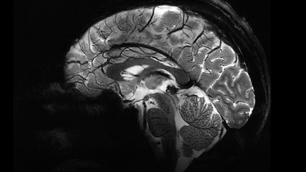 Sagittal section of the brain made using the Iseult MRI. (YouTube screenshot of the CEA film "The brain revealed like never before thanks to the most powerful MRI in the world")