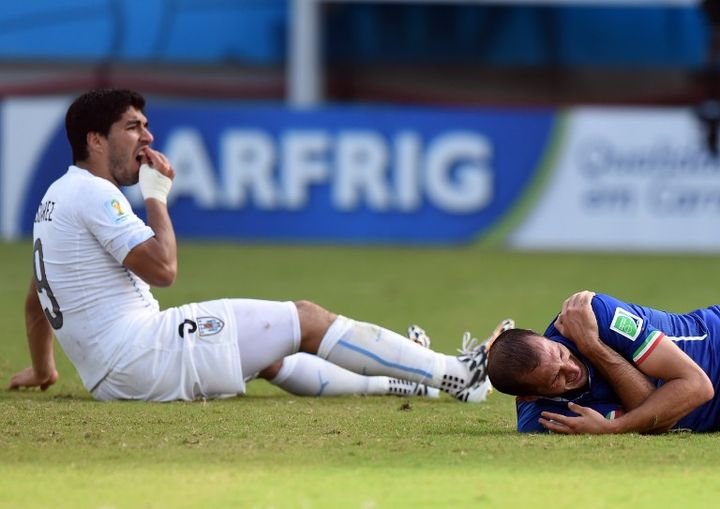 Luis Suarez (à gauche) se tenant les dents après avoir mordu le défenseur italien&nbsp;Giorgio Chiellini, le 24 juin 2014 à Natal (Brésil).&nbsp; (JAVIER SORIANO / AFP)