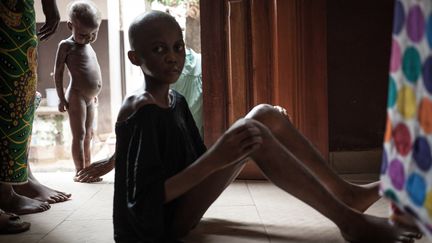 Enfants souffrant de malnutrition, photographiés au complexe pédiatrique de Bangui, le 4 décembre 2018. (FLORENT VERGNES / AFP)