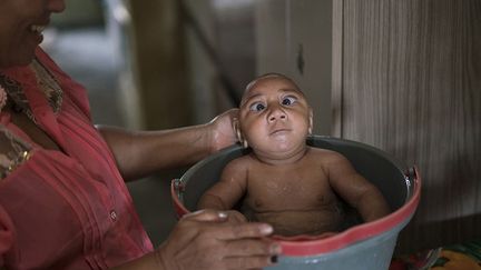 En 2015, une épidémie de Zika s’est déclarée au Brésil et s’est rapidement propagée sur tout le continent américain. Ce virus, transmis par les moustiques, peut être à l’origine de la microcéphalie, une malformation congénitale rare caractérisée par une tête anormalement petite et de graves lésions cérébrales. Des milliers d’enfants nés au Brésil depuis l’apparition de ce fléau en sont atteints. Beaucoup de femmes enceintes qui ont contracté le virus se font avorter. Felipe Dana s’est rendu dans le Nordeste, une région pauvre où se situe l’épicentre de l’épidémie, pour rencontrer des familles parmi les premières touchées par cette maladie. ( Felipe Dana )