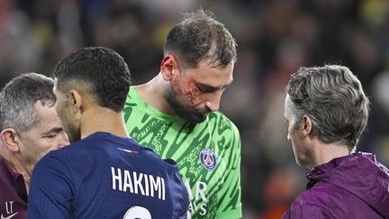 Le visage ensanglanté du gardien du PSG; Gianluigi Donnarumma, lors du match de Ligue 1 entre Monaco et le PSG, le 18 décembre 2024 au stade Louis II. (FREDERIC DIDES/SIPA / SIPA)