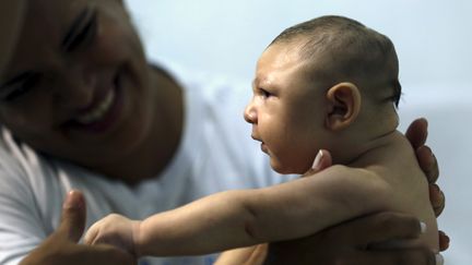 Un bébé atteint de microcéphalie, à Recife (Brésil), le 26 mars 2016. (PAULO WHITAKER / REUTERS)