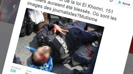  (Les médias ont bien parlé des policiers blessés et cette image vient de Thaïlande © Capture d'écran Twitter)