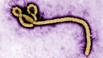 Le virus Ebola, observ&eacute; ici au microscope &eacute;lectronique,&nbsp;est un virus g&eacute;ant qui ressemble &agrave; un ver. (REUTERS)