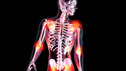 Fibromyalgie : une nouvelle thérapie centrée sur les émotions (&copy;Fotolia - Spectral Design)