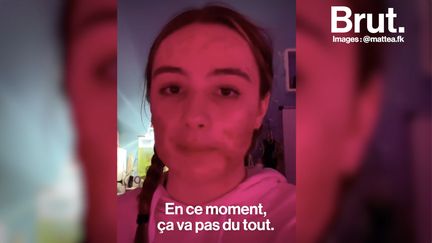 À 16 ans, Mattéa souffre d'acné sévère. Sur TikTok, elle raconte son quotidien.