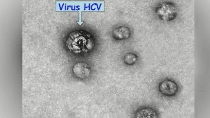 Santé : le virus de l'Hépatite C est enfin identifié