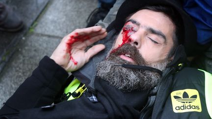 "Gilets jaunes" : nouvelle blessure polémique des forces de l'ordre