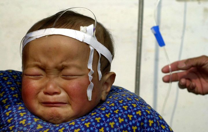 Un bébé malade reçoit une solution antibiotique intraveineuse dans une clinique de Suxiao, village de la province d'Anjui, en Chine. Alors que les antibiotiques ont amélioré la santé en Chine, les experts s'accordent à dire qu'ils sont surconsommés et ont des conséquences dangereuses. (AP Photo / Eugene Hoshiko)