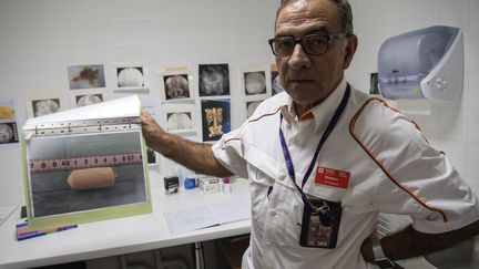 Philippe Bargain, chef des urgences de Roissy, montre une photo représentant une capsule contenant de la drogue ingérée par une mule qui a tenté de traverser les douanes. (Illustration) (CHRISTOPHE ARCHAMBAULT / AFP)