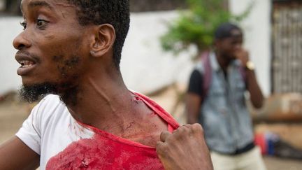 Un homme montre ses blessures. Il a été agressé près de l'UDPS, siège du parti de l'opposant historique Etienne Tshisekedi incendié dans le nuit du 19 septembre 2016. (Photo AFP/Junior D.Kannah)