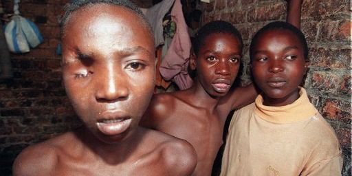 Trois jeunes Hutus, dont l'un a perdu un oeil lors des combats, dans une prison de Kigali, le 4 mai 1995. Tous trois sont accusés d'avoir participé aux massacres de Tutsis l'année d'avant. Ils avaient à peine 15 ans. (PASCAL GUYOT/AFP)