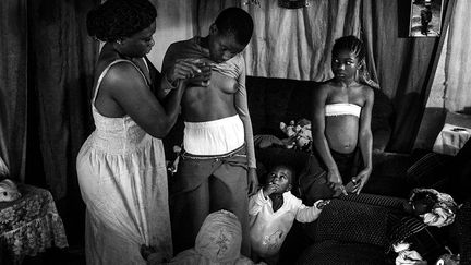 Quand les jeunes filles deviennent adolescentes, une coutume veut que l’on repasse leurs seins pour éviter qu’ils ne se développent. Les mères expliquent qu’il s’agit d’un acte d’amour pour éviter qu’elles ne se fassent violer, ne tombent enceintes et abandonnent l’école ou leur travail. Entre 25% et 50% des jeunes filles subissent cette pratique au Cameroun. Selon les Nations Unies, elle peut entraîner de nombreux  problèmes de santé, comme des lésions tissulaires et des infections.
 (Heba Khamis)