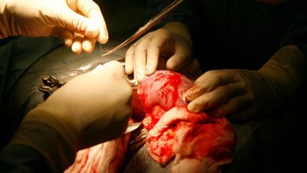 Transplantation rénale à l'hôpital Saint-Louis, à Paris. (Gettyimages/Owen Franken)