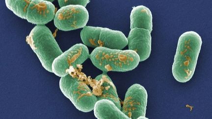 Listeria : une femme perd son enfant in utero