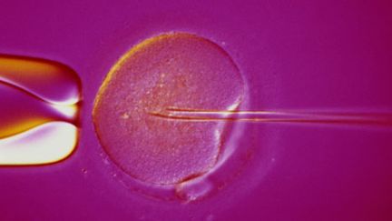 Fécondation in vitro (Getty Images - Spike Walker)