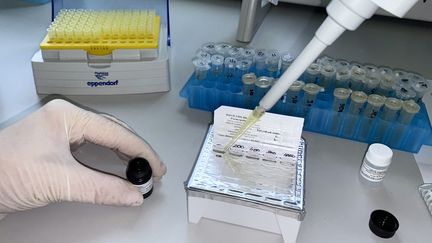 Un kit de test pour la variole du singe le 18 mai 2022 à&nbsp;Novosibirsk (Russie). (SPUTNIK / AFP)