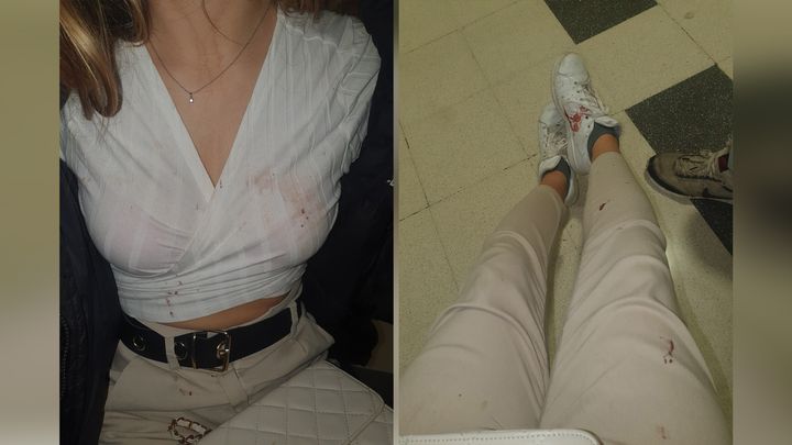 Photos d'Amanda après son agression. (DOCUMENT FRANCEINFO)