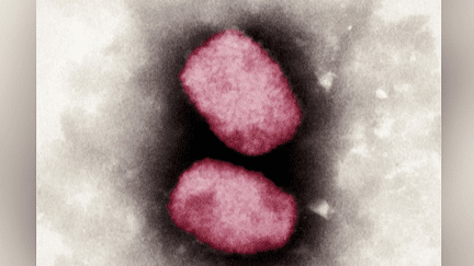 Epidémie de mpox : après la détection d'un premier cas en Europe, faut-il s'inquiéter du virus ? (france 2)